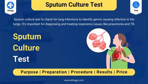 sputum test results how long|Routine Sputum Culture: Purpose, Procedure, and Side .